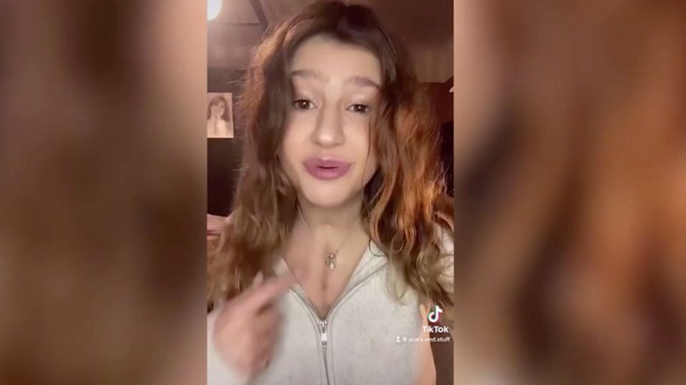 Cecilia Adamou Organspende: Frau kann ihren Herzschlag durch ihre Brust sehen
