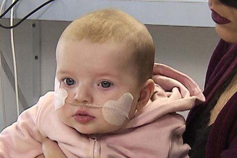 Atemwegserkrankung: Kinderkrankenhäuser schlagen Alarm: Immer mehr Fälle mit gefährlichem RS-Virus