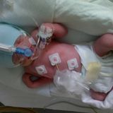 Paul, einen Tag nach der Geburt. Er ist kleiner und wiegt etwas weniger als seine Schwester Lotta.