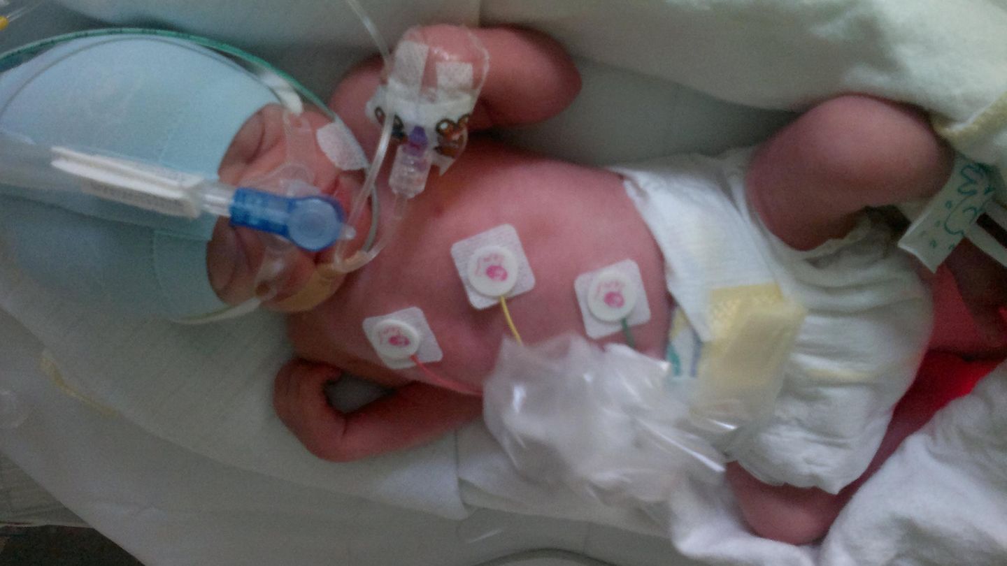 Paul, einen Tag nach der Geburt. Er ist kleiner und wiegt etwas weniger als seine Schwester Lotta.