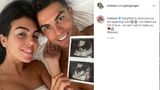 Vip-News: Cristiano Ronaldo und seine Freundin Georgina erwarten Zwillinge