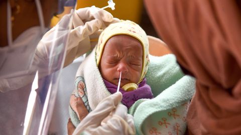 Nasenabstrich bei einem Baby in Mumbai, Indien: Lohnt eine Immunität durch "Primärinfektion"?