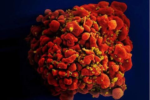 Darstellung einer mit HIV-infizierten Blutzelle