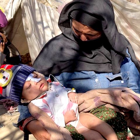 Besuch im Flüchtlingslager in Afghanistan: Eine Million Kinder vom Hungertod bedroht
