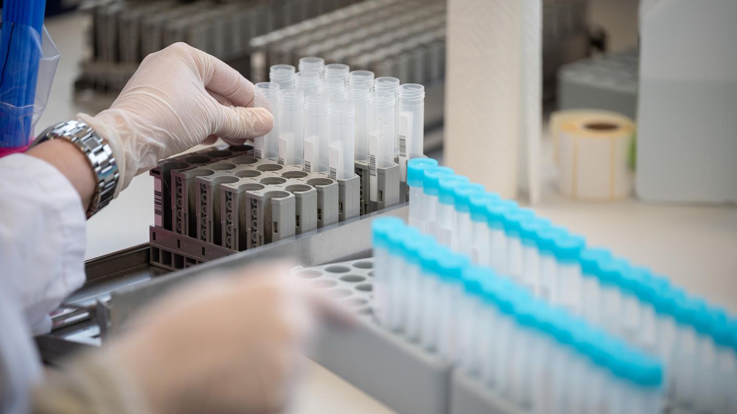 Corona: RKI reports 35,431 new infections and an incidence of 265.8
