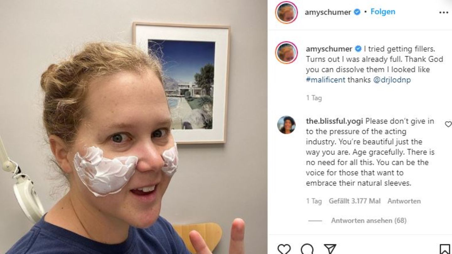 Amy Schumer