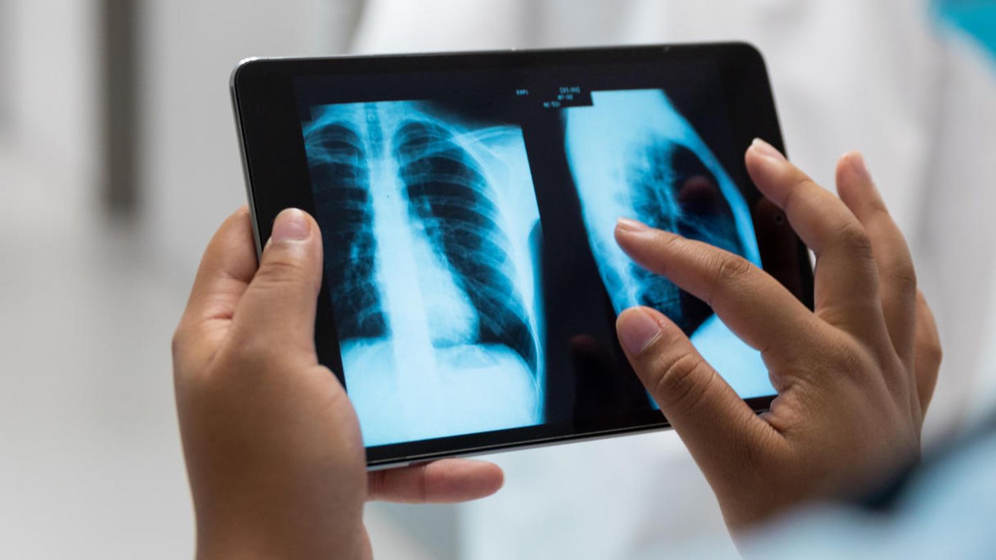 Extremely contagious, but less dangerous: new Omikron study gives hope