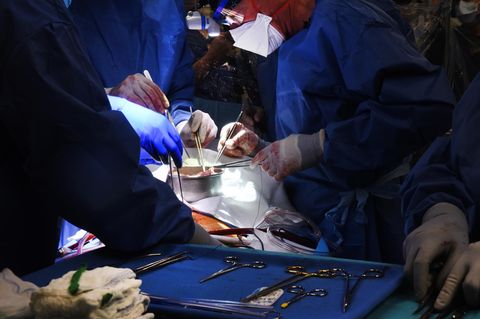 Transplantation USA Schweineherz