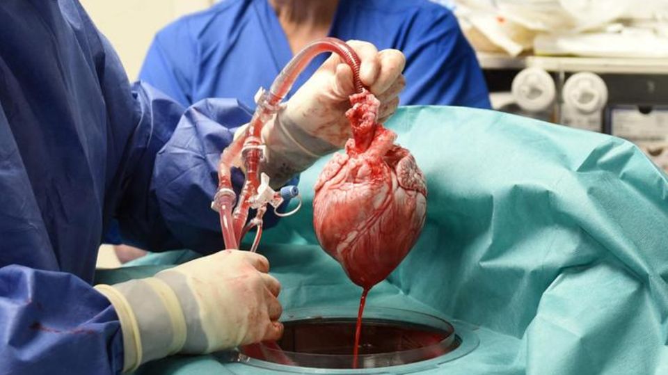 USA: Ärzte transplantieren genverändertes Schweineherz