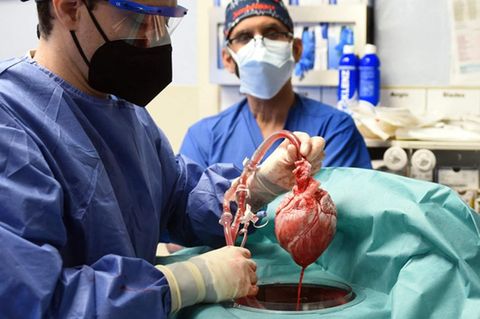 USA: Ärzte transplantieren genverändertes Schweineherz
