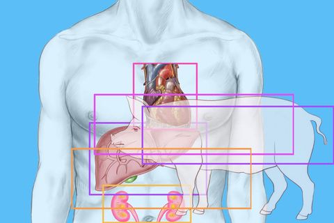 Xenotransplantation