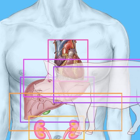 Xenotransplantation