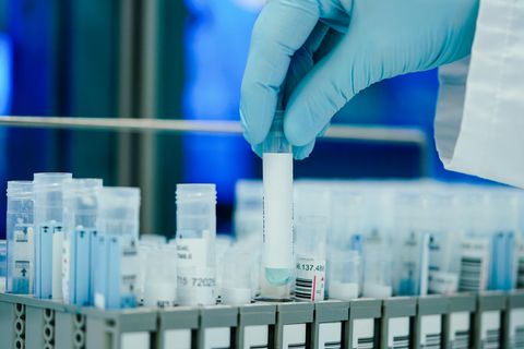 Ein Mitarbeiter hält in einem Coronatest-Labor der Limbach Gruppe PCR-Teströhrchen in den Händen