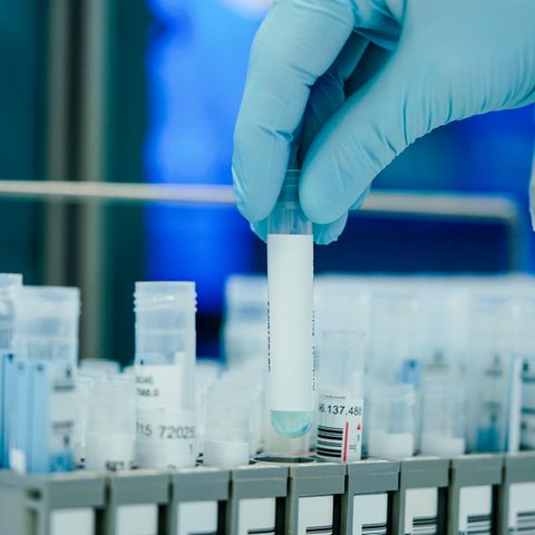 Ein Mitarbeiter hält in einem Coronatest-Labor der Limbach Gruppe PCR-Teströhrchen in den Händen