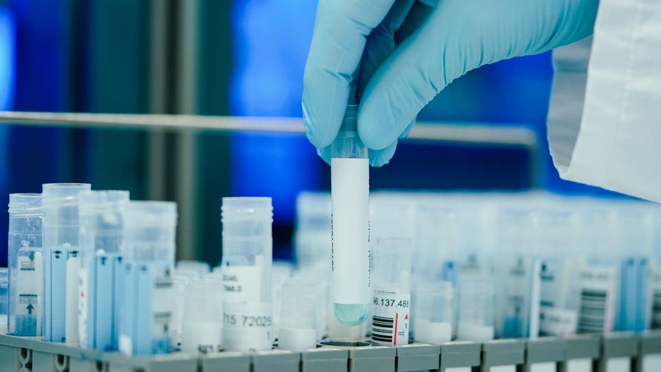 An employee holds PCR test tubes in a corona test laboratory of the Limbach Group