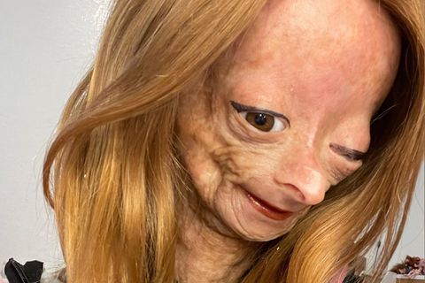 Millionen Fans trauern: YouTuberin mit seltener Alterskrankheit im Alter von 15 Jahren gestorben