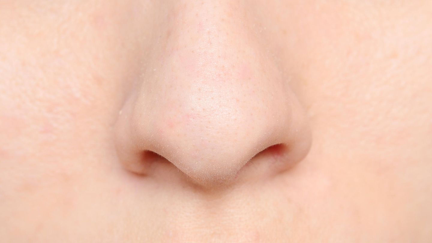 Nase