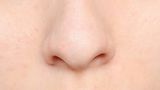 Nase