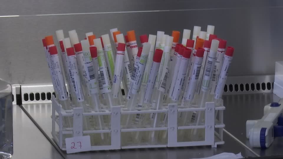 Deutschlands neue Teststrategie: Die Testlabore sind bei der Untersuchung von PCR-Tests inzwischen an ihrer Kapazitätsgrenze angelangt