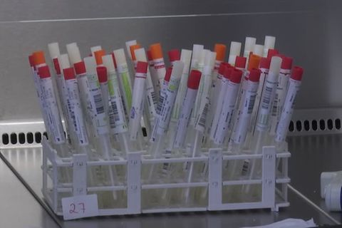 Deutschlands neue Teststrategie: Die Testlabore sind bei der Untersuchung von PCR-Tests inzwischen an ihrer Kapazitätsgrenze angelangt