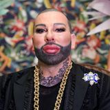 Sein Gesicht hat offenkundig einige Eingriffe hinter sich. Neben Schmuck und Mode ist auch sein großes Tattoo auffallend.