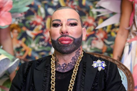 Sein Gesicht hat offenkundig einige Eingriffe hinter sich. Neben Schmuck und Mode ist auch sein großes Tattoo auffallend.