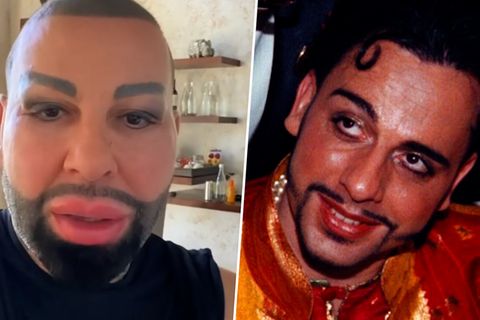 Dschungelcamp 2022: Laser, Botox und Beauty-OPs: So hat sich Harald Glööckler in 20 Jahren verändert