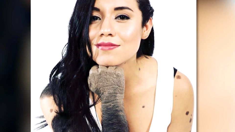 "Gorilla-Frau" über ihren emotionalen Weg vom Opfer zum Model
