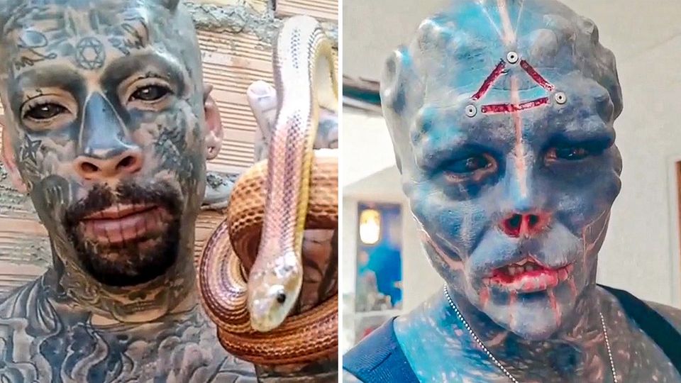 Alien-Mann bekommt Konkurrenz: Brasilianischer TikTok-Star lässt sich Ohren abschneiden