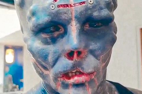 Alien-Mann bekommt Konkurrenz: Brasilianischer TikTok-Star lässt sich Ohren abschneiden