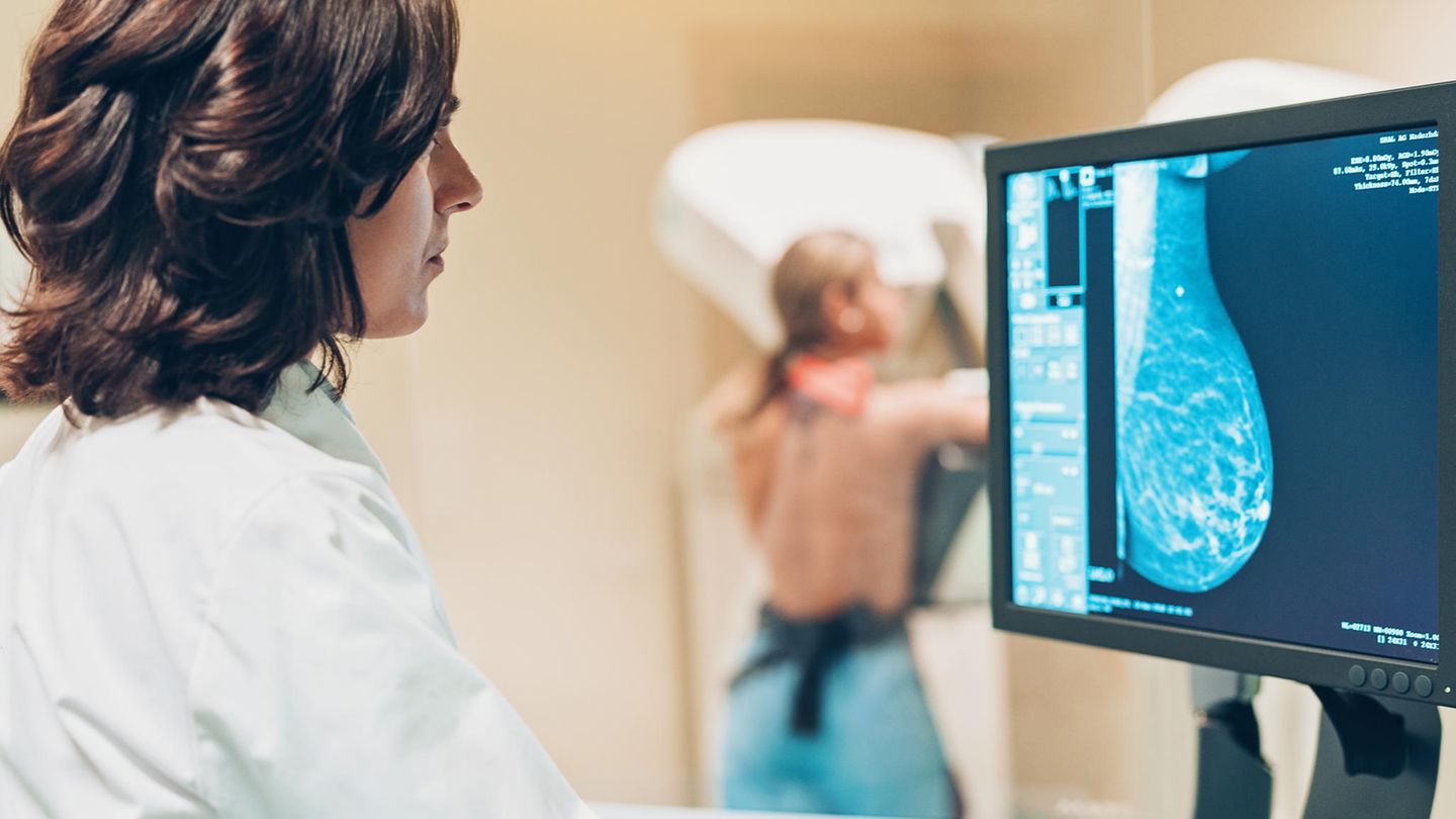 Eine Ärztin vor dem Mammografie-Bild einer Brust