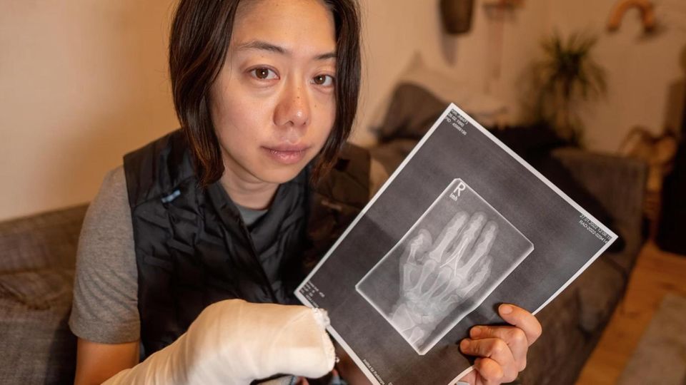 Juju Kim hält mit ihrem eingegipsten Arm ein Röngtenbild ihrer Hand