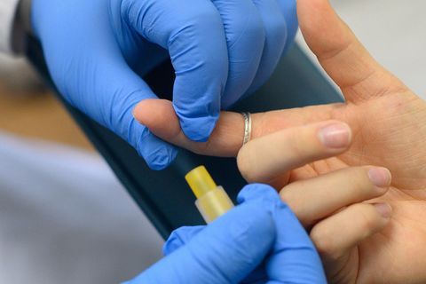 Medizinischer Durchbruch: Erste Frau gilt als von HIV geheilt (Symbolbild)