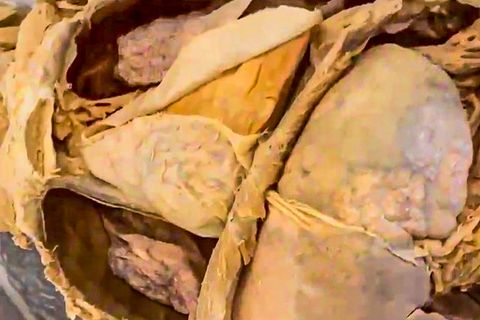 Anatomie des menschlichen Körpers mithilfe gespendeter Körperteile lernen
