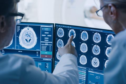 Forscher sehen sich Gehirnscans an