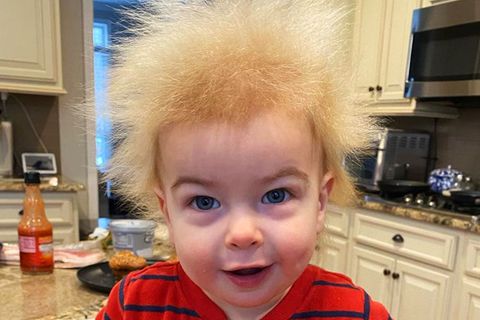 Unkämmbare Haare: Locklan hat das Struwwelpeter-Syndrom