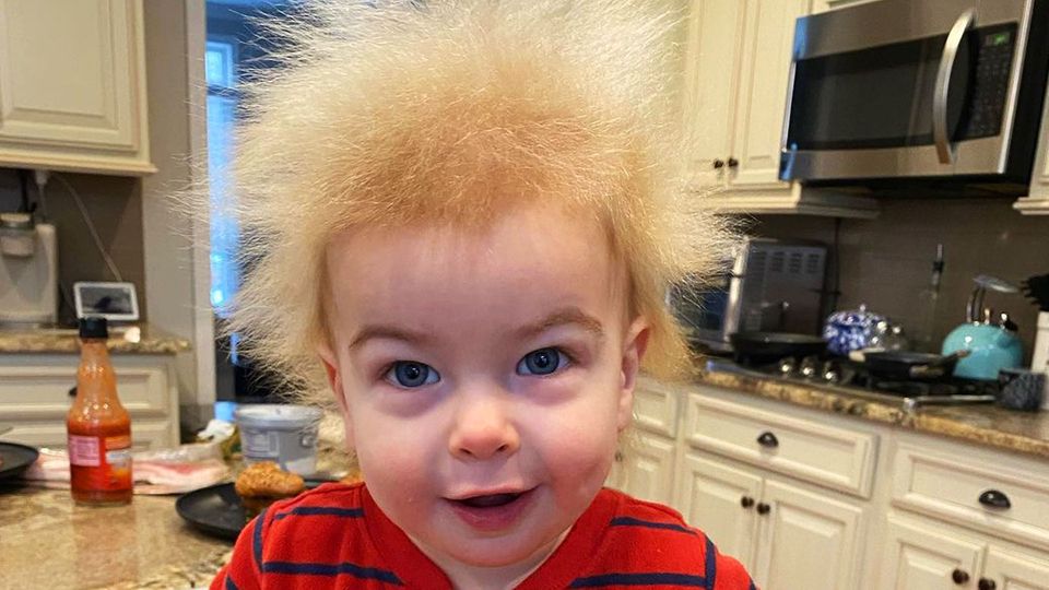 Unkämmbare Haare: Locklan hat das Struwwelpeter-Syndrom Unkämmbare Haare: Locklan hat das Struwwelpeter-Syndrom