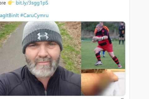 Ein Foto eines Mannes mit Bart, eine Rugby-Spielers und einer Wade auf Twitter