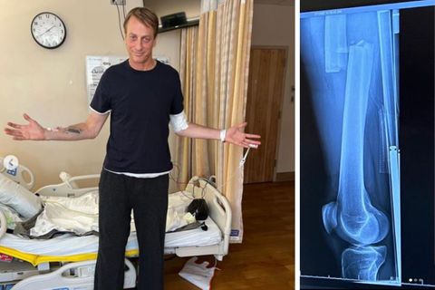 Tony Hawk