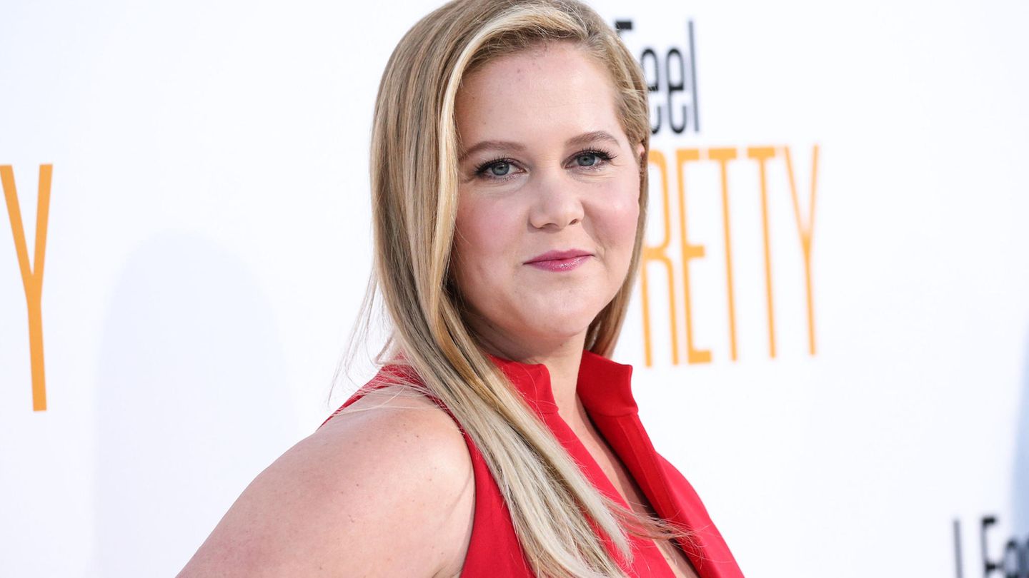 Vip News: Amy Schumer talks about her liposuction