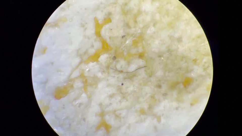 Video: Forscher in Brasilien: unerwartet viel Mikroplastik in Meerestieren