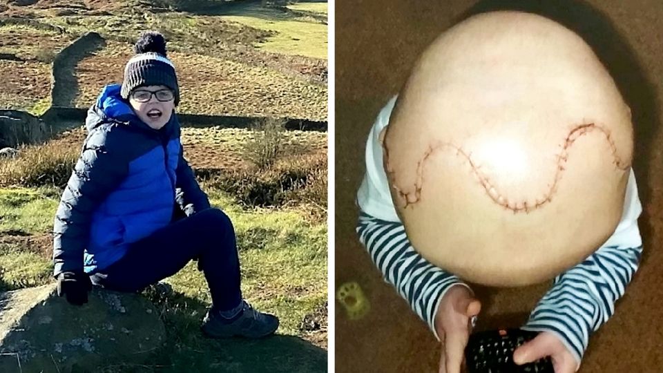 Ungewöhnliche Schädel-OP rettet Jungen das Leben – jetzt will Daniel „Danke" sagen