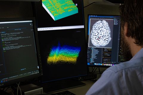 ALS-Patient kann dank Hirnimplantat wieder sprechen