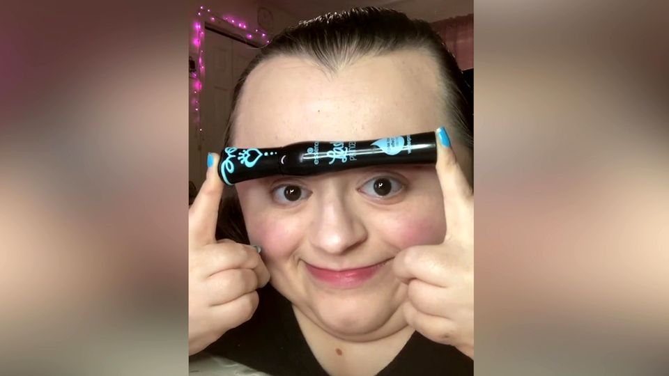 Beauty-Influencerin mit Glasknochenkrankheit erobert die sozialen Medien