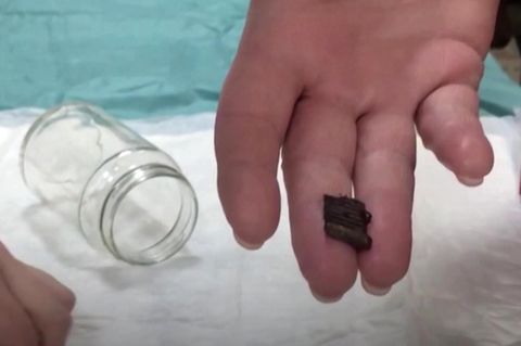 Ukraine-Krieg: Magnete ziehen in Krankenhaus Metall aus Wunden