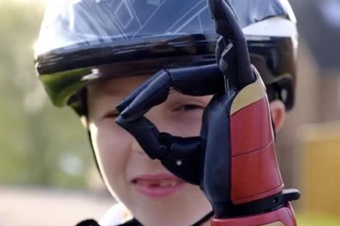 Junge mit Iron-Man Prothese für seine linke Hand lächelt
