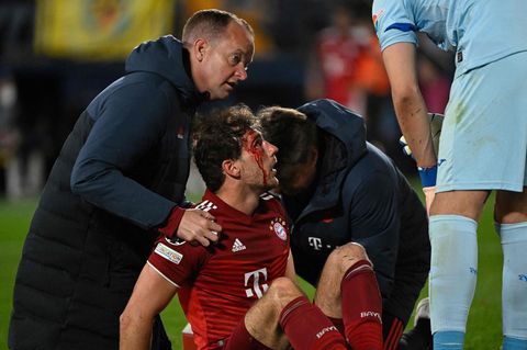 Leon Goretzka erwischte in der Schlussphase, als er bei einem Kopfballduell einen Arm ins Gesicht bekam