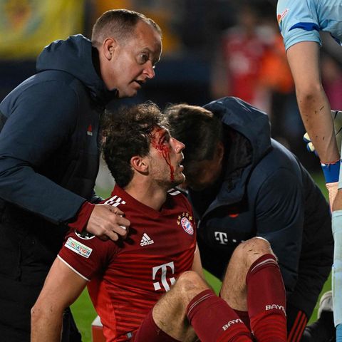 Leon Goretzka erwischte in der Schlussphase, als er bei einem Kopfballduell einen Arm ins Gesicht bekam