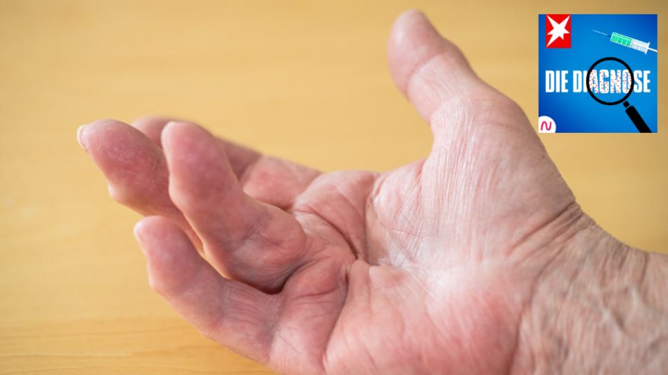 Innenfläche der Hand mit abstehendem Ringfinger