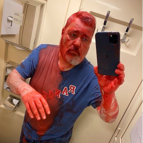 Ukraine Krieg: Der Chefredakteur Dmitri Muratow ist mit roter Farbe attackiert worden